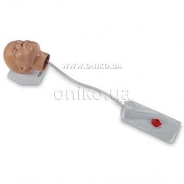 Nasogastrická intubace