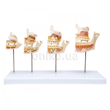 Model vývoje zubů