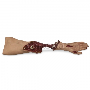 Model kriticky zraněné ruky